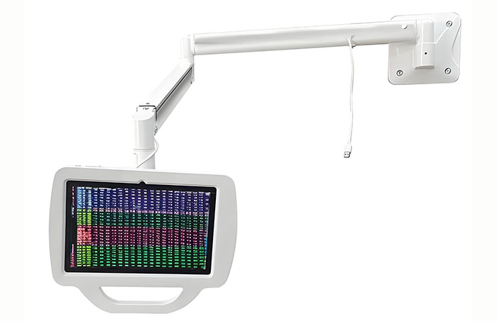 病床支架機(jī)械手鋁型材